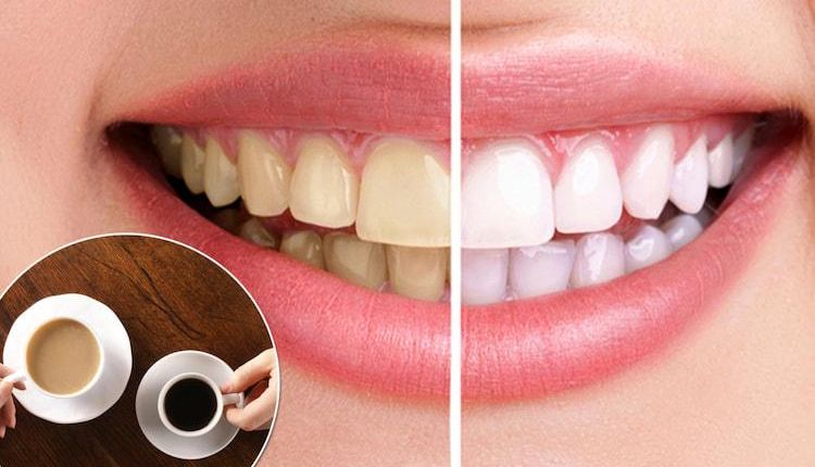 How to Whiten Your Teeth at Home (Simple and Safe)