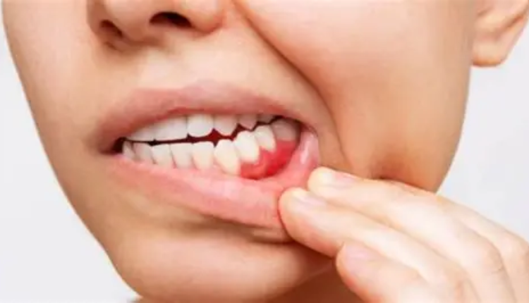 What Do Your Teeth Have to Do with Weight Loss? (More Than You Think)