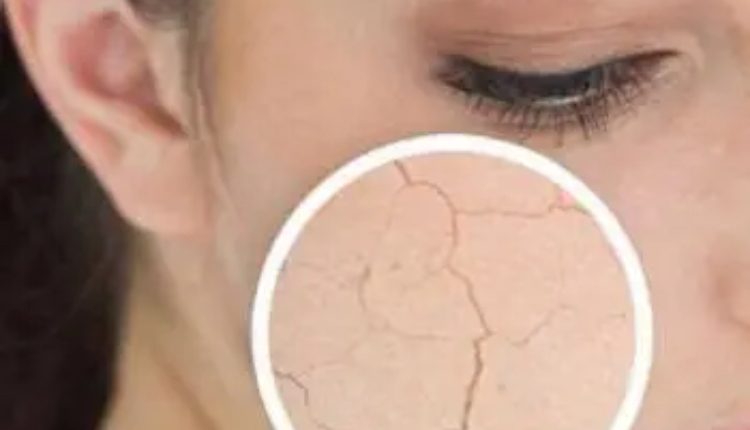Winter’s Here and Your Skin’s Dry? Here’s How to Fix It Simply and Effectively